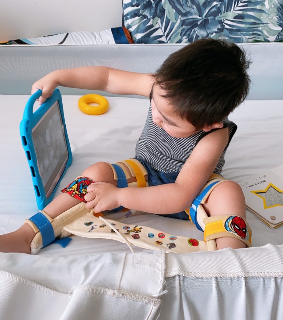 A young boy with dark hair in a blue and white striped shirt and blue shorts is sitting on a bed. He is wearing leg splints with cartoon pictures on them. The boy is holding a hand-held blue picture communication device and looking at it