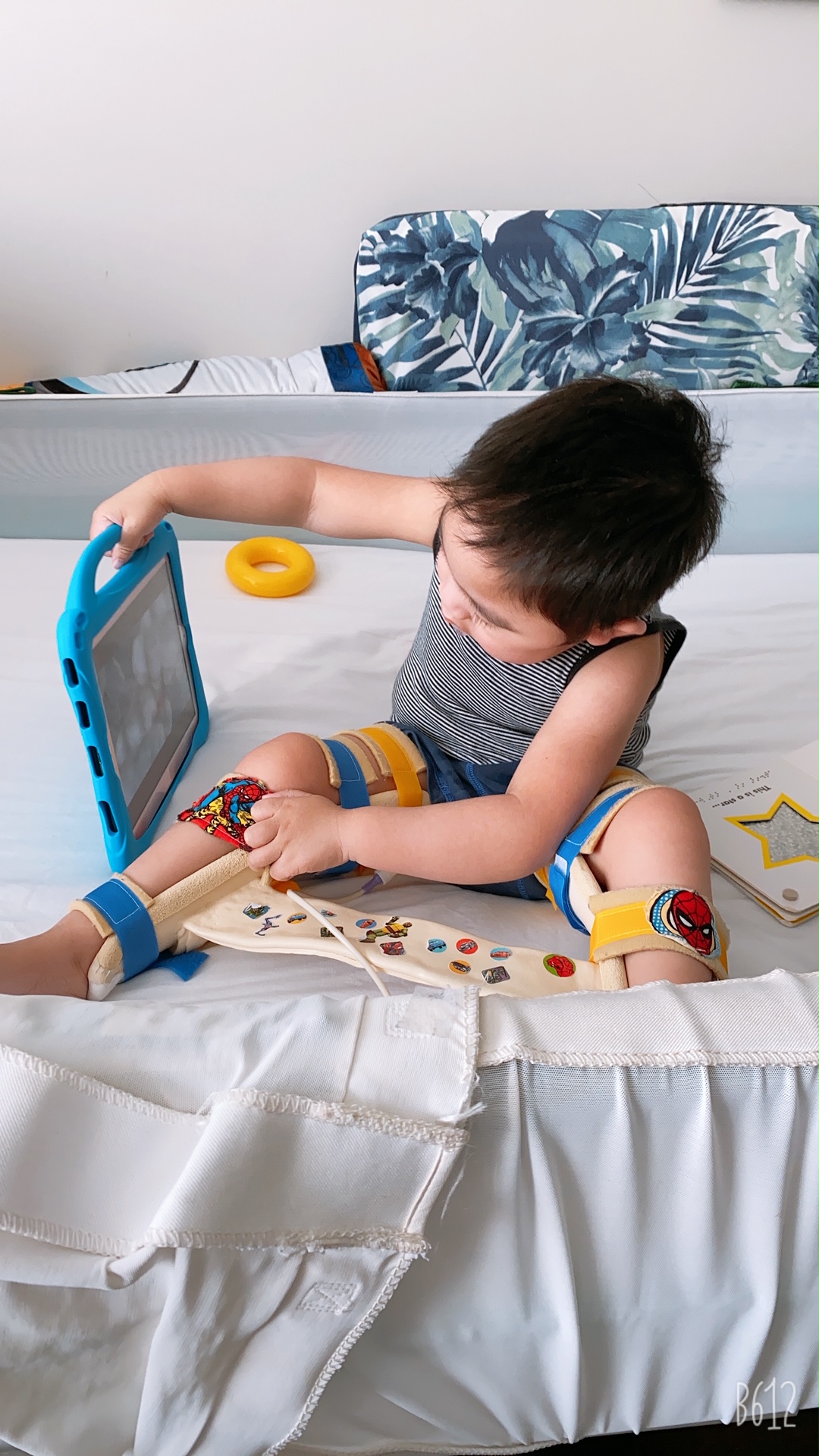 A young boy with dark hair in a blue and white striped shirt and blue shorts is sitting on a bed. He is wearing leg splints with cartoon pictures on them. The boy is holding a hand-held blue picture communication device and looking at it